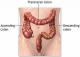 7 Effective Facts Of Colon Cleansing